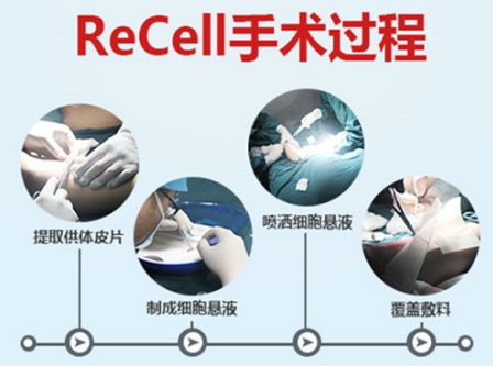 祛白黑科技――Recell自体活性皮肤细胞移植再生术